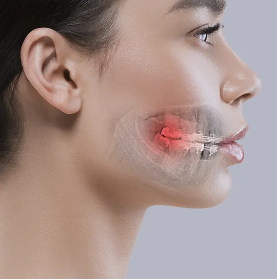 Cirurgia Bucomaxilofacial